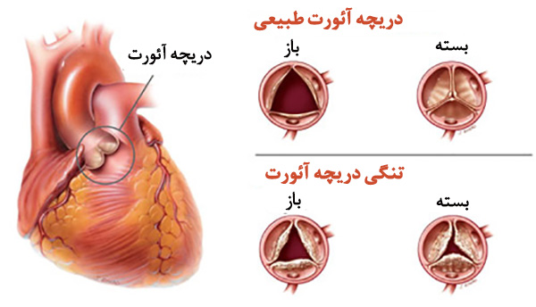دکتر زاگرس حسنیانی|متخصص قلب و عروق