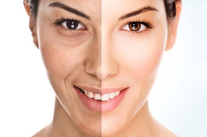 دکتر ریما سرحدیان | متخصص پوست