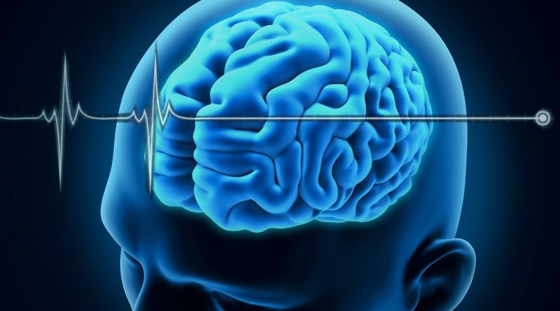 دکتر چیا پروتی قلات|متخصص جراحی مغز و اعصاب
