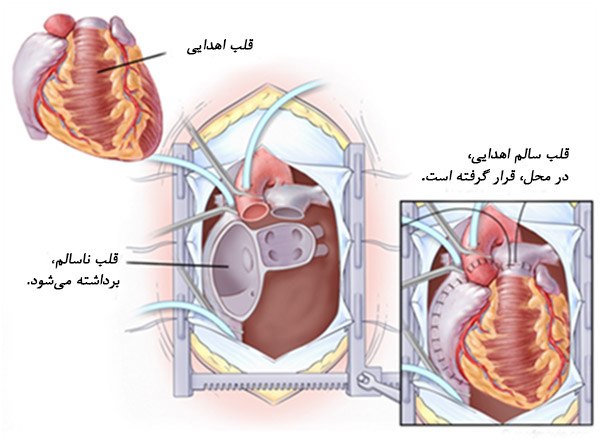دکتر جلال الدین مولوی|متخصص قلب و عروق